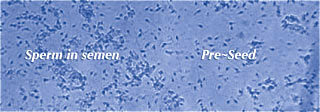 Sperm movement image 2