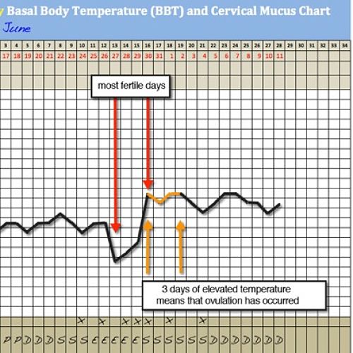 Bbt Chart Gallery