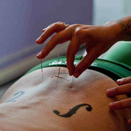 Acupunctura e Fertilidade: Pode esta prática tradicional chinesa melhorar a fertilidade?